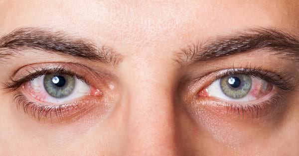 Болезни глаз у человека: список заболеваний с описанием симптомов
