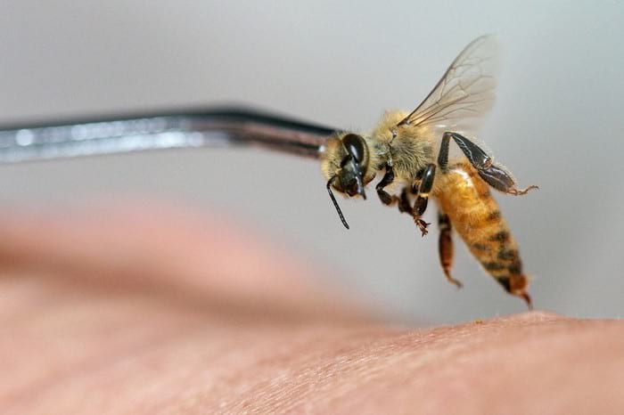 Лечение пчелами: методика проведения процедуры