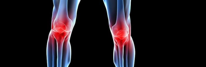 Причины, симптомы и способы лечения остеоартроза коленного сустава