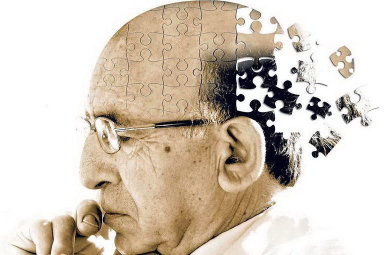 7 стадий болезни Альцгеймера: признаки и симптомы