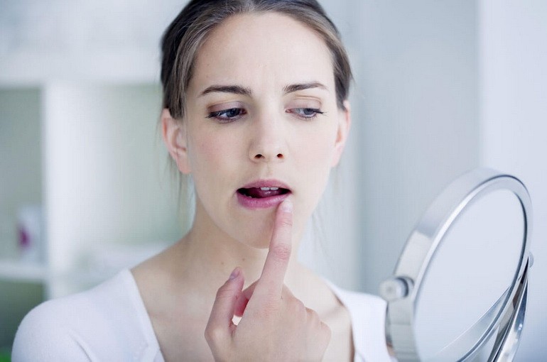 Трещины на губах (в уголках рта): какого витамина не хватает?